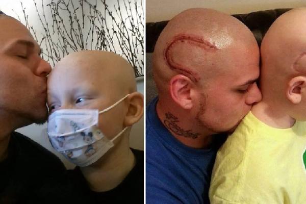 Najbolji tata na svetu! Istetovirao je ožiljak na glavi da bi se njegov sin osećao bolje (FOTO)