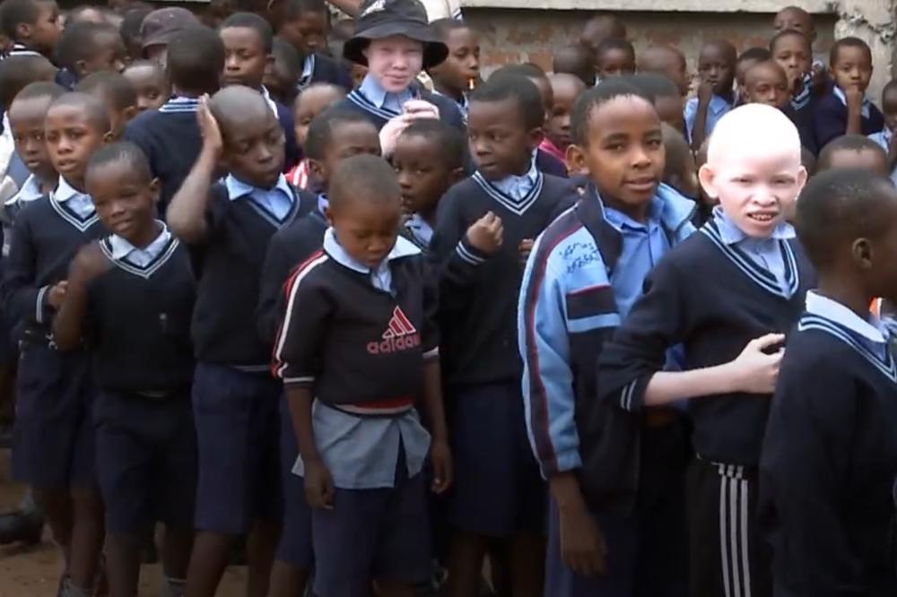 Bolesna priča o albino deci u Africi: Proganjaju ih i love zbog izgleda kao trofeje! (VIDEO)