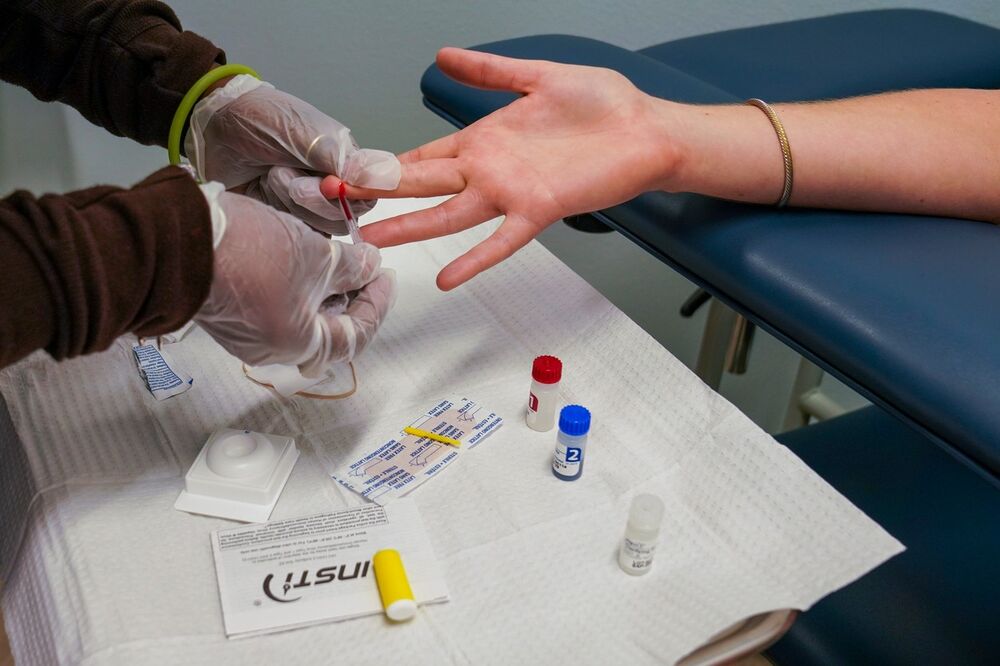 Testiranje na HIV