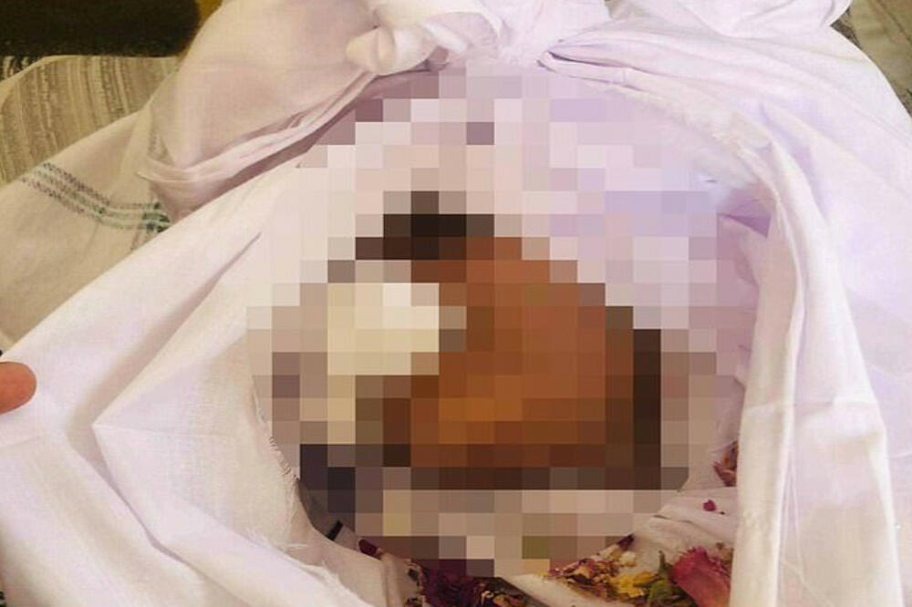 NEIZMERNA TUGA: Devojčica na smrt pregažena u Kabulu, nije joj bilo SPASA