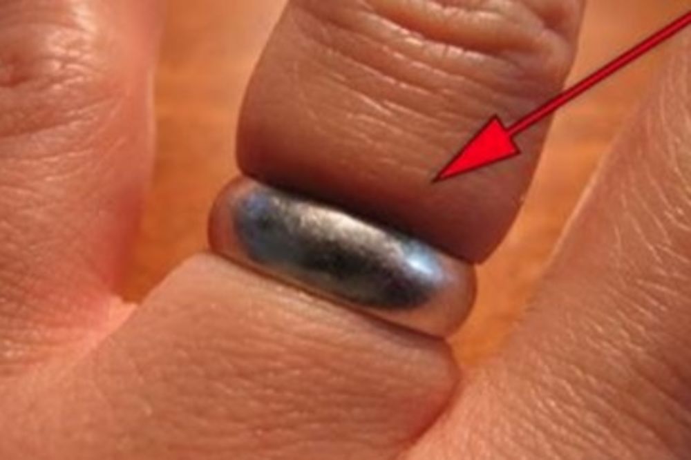 Ne možete da skinete prsten? Evo trika kako da sklizne s vašeg prsta (VIDEO) (FOTO)