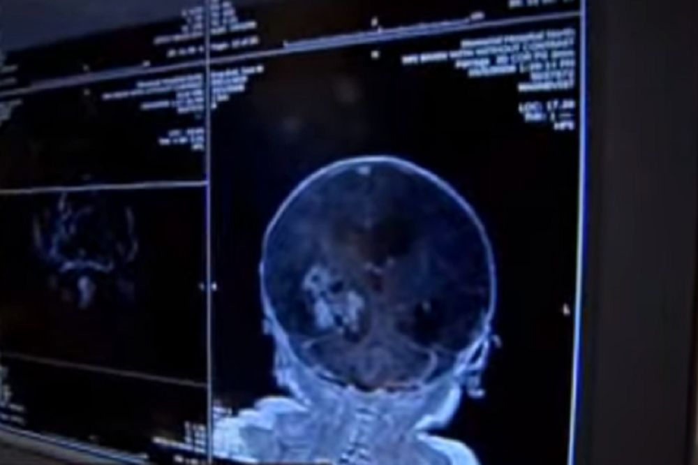 Mislili su da dečak ima tumor na mozgu, a onda su doktori otkrili jezivu istinu! (VIDEO)