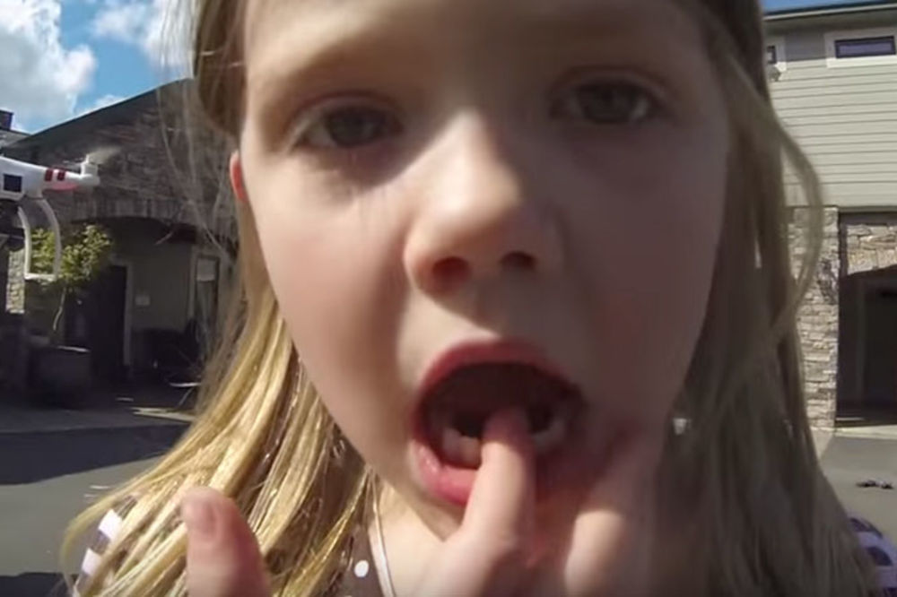 Par zanimljivih ideja kako detetu da izvadite zub (VIDEO)