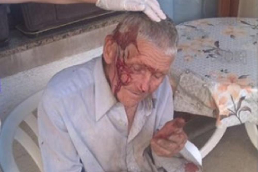 Slika pretučenog starca potresla Srbiju! Kad čujete priču koja krije istinu, naježićete se! (FOTO)