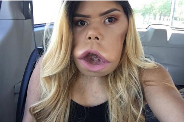 Devojka s tumorom na licu izazvala je ceo svet i redefinisala pojam lepote! (FOTO) (VIDEO) (ANKETA)