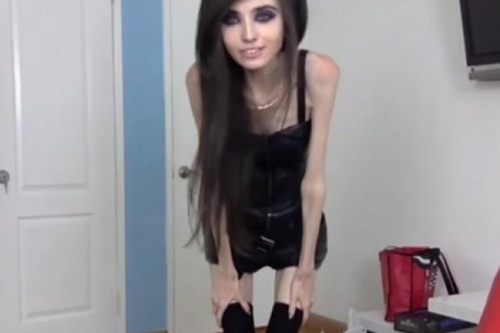 Učinite nešto, ona umire pred kamerama! Noge kao čačkalice, ispala vilica! Ova devojka promoviše anoreksiju, ljudi u šoku! (FOTO) (VIDEO)