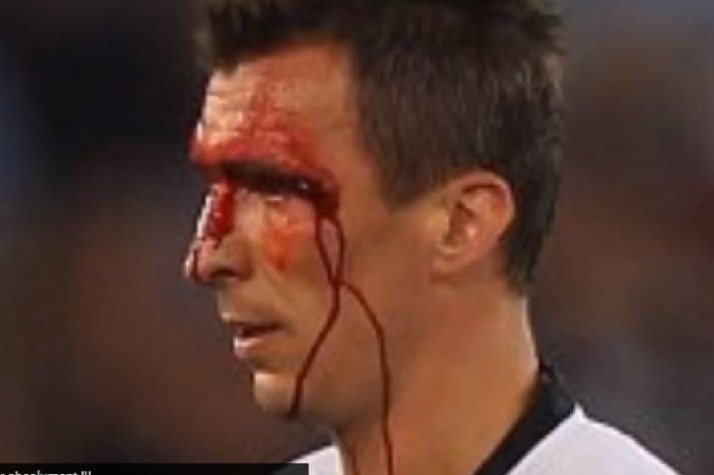 ON NE ODUSTAJE: Hrvat obliven krvlju jurišao po terenu za Juventusov trofej Kupa! (FOTO) (VIDEO)