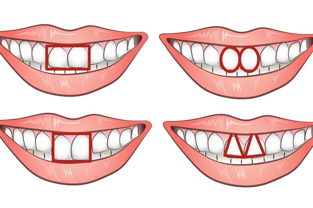 Šta oblik vaših zuba otkriva o vašem karakteru? (FOTO)