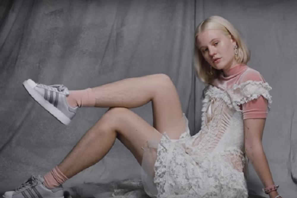 NIJE SE IZDEPILIRALA, PA DOBILA PRETNJE! Devojka se pojavila sa dlakavim nogama u reklami za Adidas, pa preživela pravi pakao! (VIDEO)