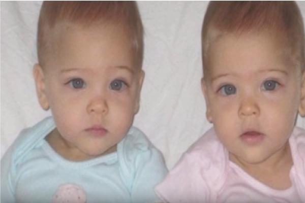 Rođene su 2010. godine kao identične bliznakinje! Danas važe za najlepše na svetu!