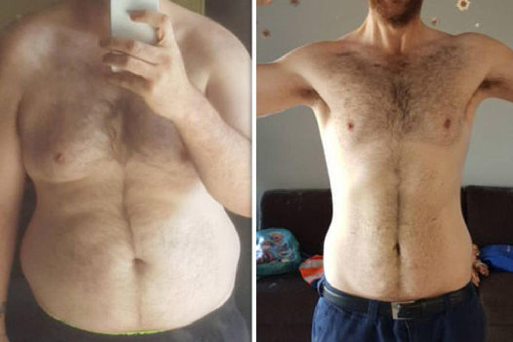 Izbacio je SAMO JEDNU STVAR iz ishrane i smršao 55 KILA: Evo kako da izgubite višak kilograma bez gladovanja