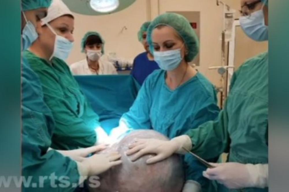 SRPKINJA REKORDERKA! U stomaku nosila tumor težak 30 kilograma, operacija u kruševačkoj bolnici ŠOKIRALA SVET! (FOTO)