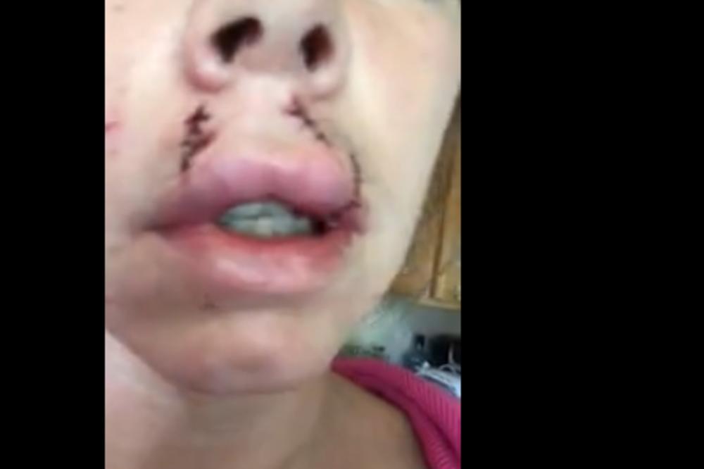 NAPAO JU JE PITBUL: Ovako je njeno lice izgledalo posle napada! (VIDEO)