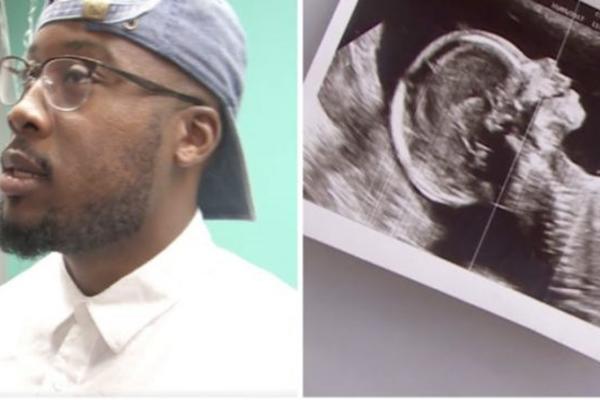TATA SE ONESVESTIO NAKON ŠTO JE VIDEO ULTRAZVUK: Ima troje dece, ali sada je njegova supruga ponovo trudna (VIDEO)