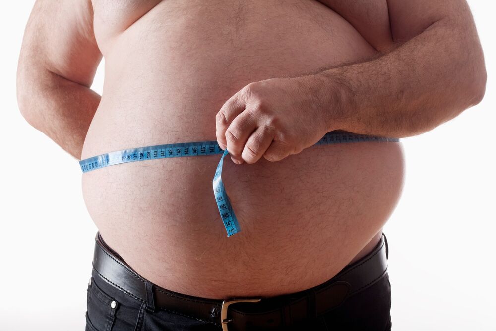 Gojaznost kao jedan od velikih problema  