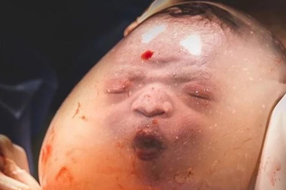 BEBA SE RODILA U VREĆICI, MAJCI NIJE PUKAO VODENJAK: Plakala sam dok sam ga rađala! (FOTO)