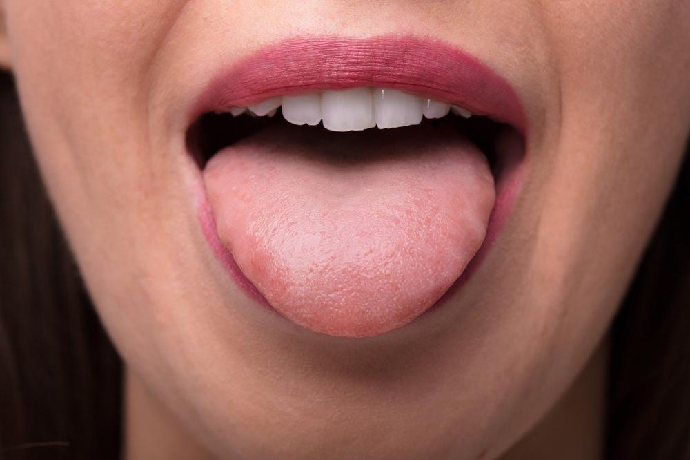 HITNO! STRUKA UPOZORILA NA JOŠ JEDAN SIMPTOM KORONE: Obratite pažnju na jezik!