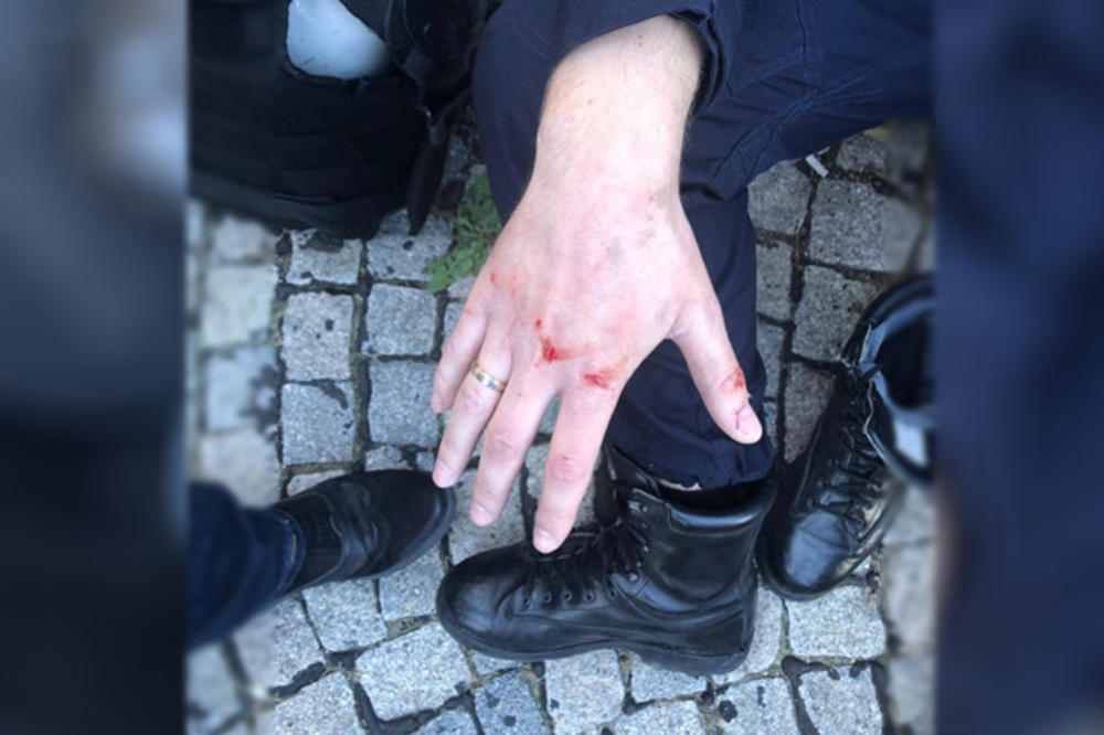 DVA POLICAJCA POVREĐENA, PREVEZENI U URGENTNI CENTAR: Incident u centru Beograda na DEMONSTRACIJAMA (VIDEO)