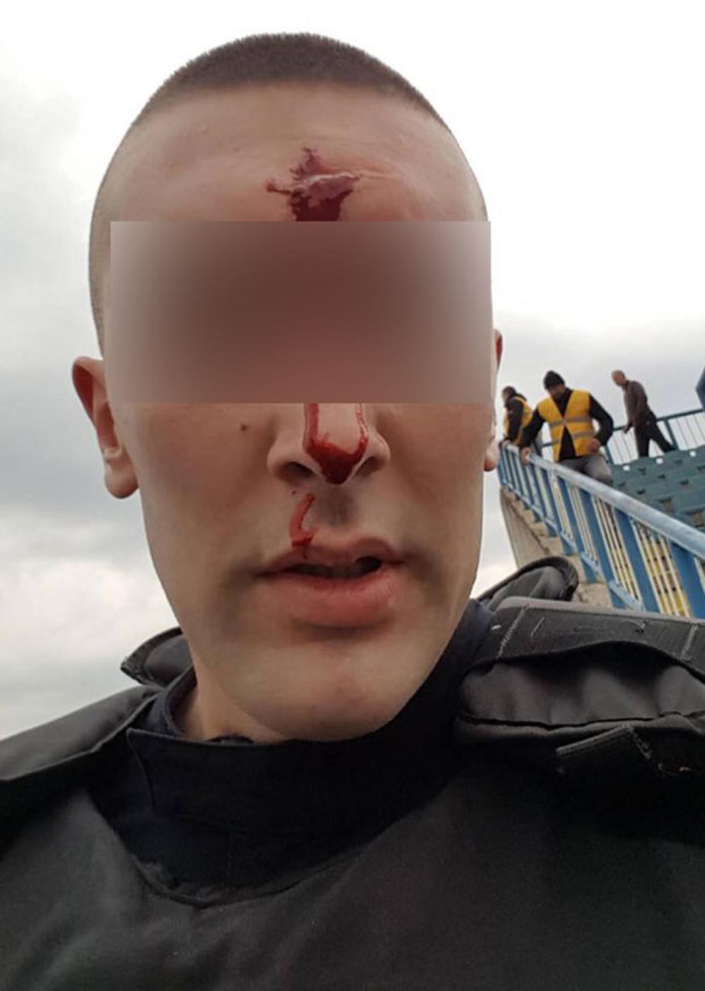Povređeni policajac iz tuče Varvara i policije