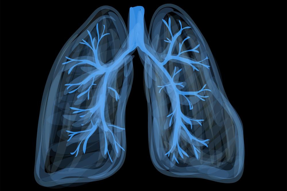 OVI SIMPTOMI NISU BEZAZLENI, UKOLIKO IH OSETITE OBRATITE SE LEKARU: Mogu upozoriti na upalu pluća
