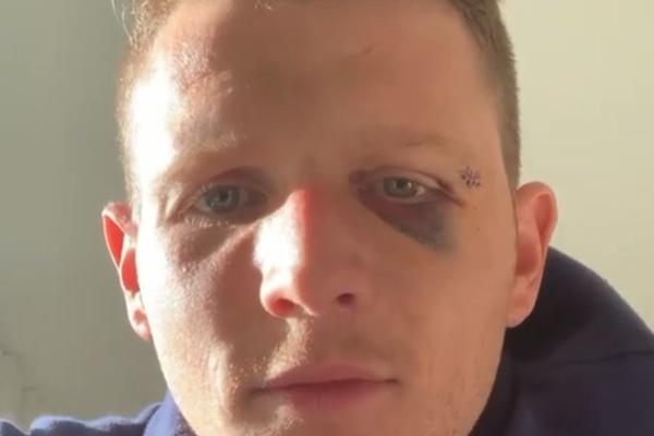 REPREZENTATIVAC ZAVRŠIO KARIJERU U 28. GODINI: Izgubio vid na levom oku zbog jezivih povreda na utakmici!