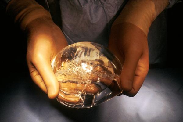 BIZARNIJE NE MOŽE: Pogledajte kako su žene UVEĆAVALE GRUDI pre plastičnih operacija