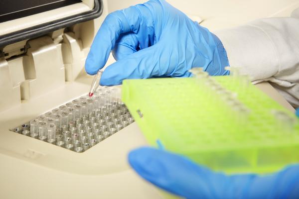 NAKON ŠTO JE NEMAČKA UVELA OBAVEZAN NEGATIVAN PCR ZA VOZAČE KAMIONA, DESILO SE OVO: Odmah su se oglasili NADLEŽNI