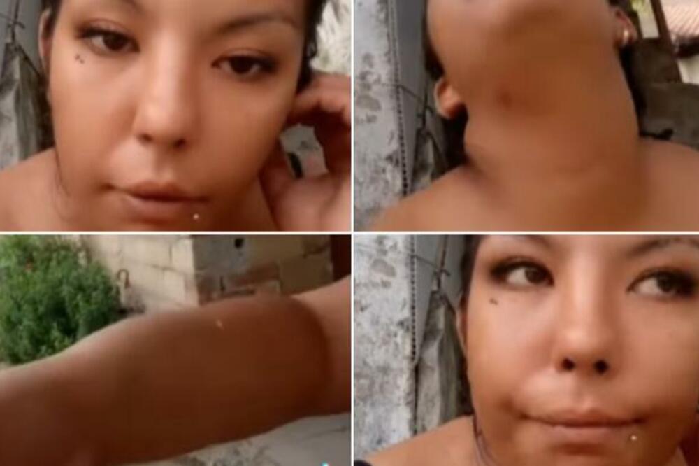 "DAVIO ME, JEDVA GOVORIM": Mučna ispovest devojke koju je nasilnik PREBIO dok je držala DETE U NARUČJU! (VIDEO)