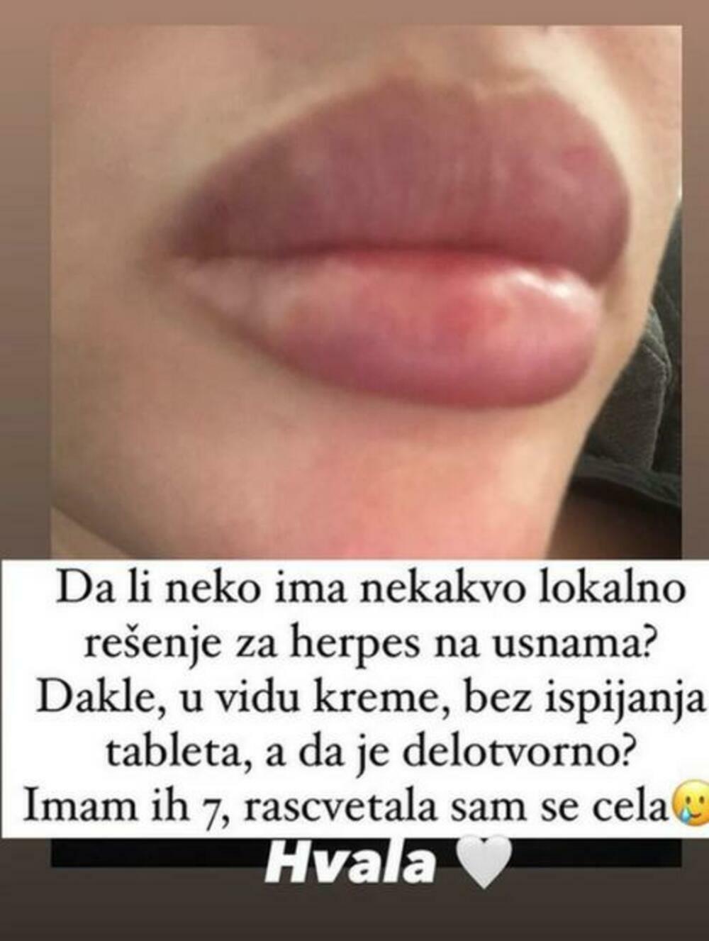 Mina Naumović uslikala je svoje usne u krupnom kadru i sve objavila na svom storiju na Instagramu