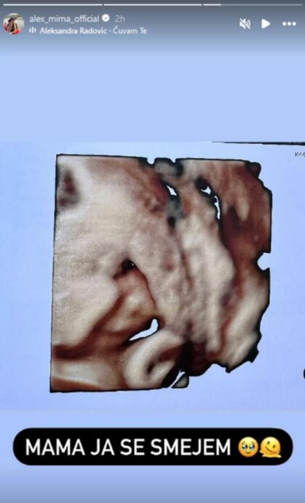 Aleksandra Nikolić objavila sliku ultrazvuka