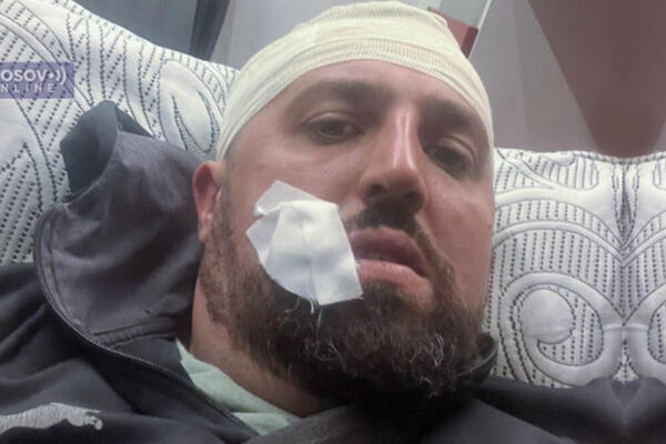 SRBIN PRETUČEN NA KOSOVU: Kosovski specijalci mu pretili pištoljem, ima povrede po glavi i telu